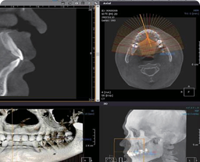 3D CT 이미지 영역